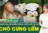 Bản Tin Y Tế 22/2: Chó cưng liếm vào vết xước nhỏ, người phụ nữ nhiễm trùng huyết mất tứ chi