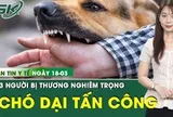 Bản tin Y tế 18/3: 3 người dân bị chó dại tuột xích tấn công nguy kịch