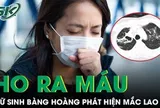 Ho ra máu giữa đêm, nữ sinh bàng hoàng phát hiện mắc lao dù không có dấu hiệu rõ rệt