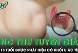 Bé 13 tuổi ung thư tuyến giáp, bác sĩ cảnh báo dấu hiệu dễ bỏ qua