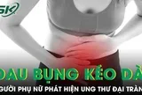 Đau bụng kéo dài tưởng rối loạn tiêu hoá, người phụ nữ phát hiện ung thư đại tràng