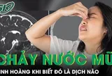 Sổ mũi nhiều ngày, người phụ nữ kinh hoàng khi biết đó là dịch não