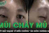 Mũi chảy mủ 4 ngày, nam thanh niên 20 tuổi suýt mất mạng