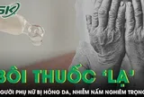 Người phụ nữ bị hỏng da, nhiễm nấm nghiêm trọng sau khi bôi "thuốc lạ"