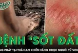 Bệnh ‘sốt đất’ bùng phát tại Thái Lan khiến hàng chục người tử vong
