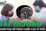 Người phụ nữ tăng chiều cao bất thường ở tuổi 40