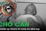Chó cắn, 3 người tại TPHCM tử vong do bệnh dại