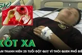 Xót xa: Nam thanh niên 25 tuổi đột quỵ vì thói quen phổ biến giới trẻ