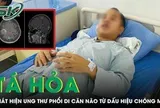 Người đàn ông tá hỏa phát hiện ung thư phổi di căn não từ dấu hiệu chóng mặt
