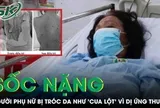 Tự ý dùng thuốc, người phụ nữ sốc nặng khi da bị tróc như 'cua lột'