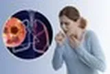 Không hút thuốc vẫn bị ung thư phổi: 2 yếu tố hầu như ai cũng gặp mỗi ngày