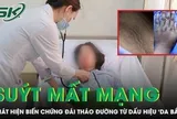 Tưởng da bẩn, cô gái 20 tuổi suýt mất mạng vì biến chứng đái tháo đường
