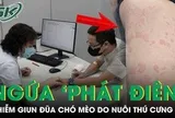 Ngứa ‘phát điên’, người đàn ông đi khám phát hiện nhiễm giun đũa chó mèo