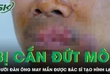 Người đàn ông bị cắn mất môi phải trải qua ca tạo hình phức tạp