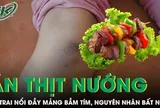 Bé trai nổi đầy mảng bầm tím sau bữa ăn thịt nướng, bác sĩ phát hiện nguyên nhân bất ngờ