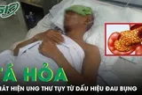 Bé trai 14 tuổi nguy kịch vì bệnh dại sau 6 tháng bị chó nhà cắn