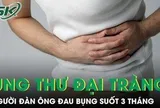 Đau bụng suốt 3 tháng người đàn ông phát hiện ung thư đại trực tràng