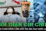 Uống 3.000 cốc trà sữa thay nước lọc suốt 9 năm, thận cô gái mọc chi chít sỏi