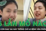 Cô gái trải qua 5 lần mổ não từ cơn đau vai gáy tưởng chỉ là bệnh văn phòng