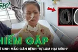 Nữ sinh 19 tuổi mắc căn bệnh 'tự làm hại mình' hiếm gặp