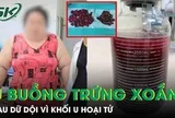 Cô gái nặng 120kg đau bụng dữ dội vì hoại tử khối u buồng trứng xoắn 20cm