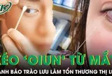 Rộ trào lưu kéo 'giun' từ mắt để thải độc gây nguy cơ tổn thương thị lực