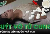 Thai phụ 31 tuần suýt vỡ tử cung vì uống 20 viên thuốc phá thai