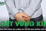Nam thanh niên dương tính cùng lúc 6 bệnh lây truyền qua đường tình dục