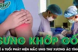 Sưng khớp gối kéo dài, bé trai 6 tuổi phát hiện mắc ung thư xương ác tính