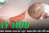 Ngỡ viêm đường tiết niệu, người phụ nữ bất ngờ phát hiện vòng tránh thai 'lạc' vào bàng quang