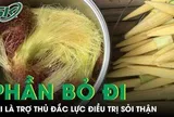 Phần thường bị bỏ đi của bắp ngô lại là 'trợ thủ đắc lực' hỗ trợ điều trị sỏi thận