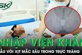 Người đàn ông nhập viện khẩn vì đầu vòi xịt mắc sâu trong trực tràng