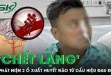 Đau đầu tưởng say nắng, người đàn ông 50 tuổi 'chết lặng' phát hiện 2 ổ xuất huyết não