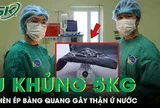 Người phụ nữ 53 tuổi mang khối u xơ tử cung khổng lồ nặng gần 5kg chèn ép bàng quang