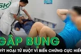 Gập bụng vài phút, người đàn ông suýt hoại tử ruột vì biến chứng cực hiếm