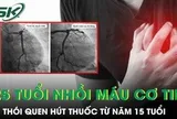 Hút thuốc từ năm 15 tuổi, nam thanh niên 25 tuổi bất ngờ nhồi máu cơ tim