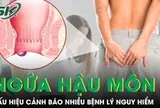 Ngứa hậu môn kéo dài có thể là dấu hiệu cảnh báo nhiều bệnh lý nguy hiểm