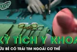 Bé trai chào đời với trái tim nằm ngoài cơ thể