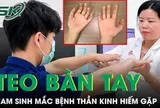 Nam sinh 17 tuổi bàn tay teo nhỏ dần do mắc căn bệnh thần kinh hiếm gặp