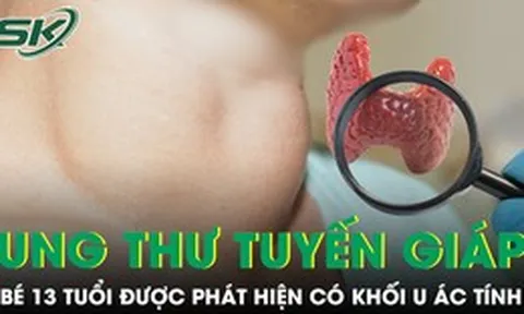 Bé 13 tuổi ung thư tuyến giáp, bác sĩ cảnh báo dấu hiệu dễ bỏ qua