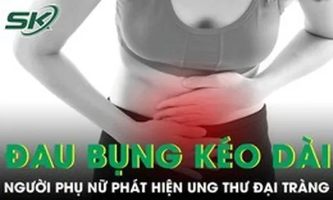 Đau bụng kéo dài tưởng rối loạn tiêu hoá, người phụ nữ phát hiện ung thư đại tràng