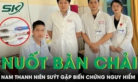 Nuốt 3 bàn chải dài 20cm, nam thanh niên suýt gặp biến chứng nguy hiểm