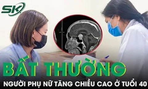 Người phụ nữ tăng chiều cao bất thường ở tuổi 40