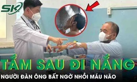 Tắm ngay sau đi nắng về, người đàn ông bất ngờ đột quỵ nhồi máu não