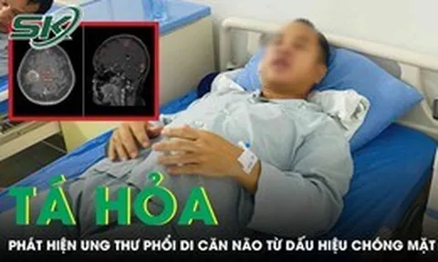 Người đàn ông tá hỏa phát hiện ung thư phổi di căn não từ dấu hiệu chóng mặt