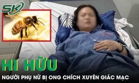 Ong chích xuyên giác mạc, người phụ nữ sưng phù mắt phải cấp cứu khẩn
