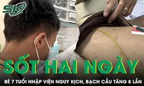 Bé trai 7 tuổi nhập viện nguy kịch sau hai ngày sốt, bạch cầu tăng 8 lần