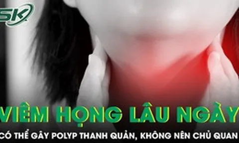 Đừng xem nhẹ bệnh viêm họng vì có thể gây polyp thanh quản