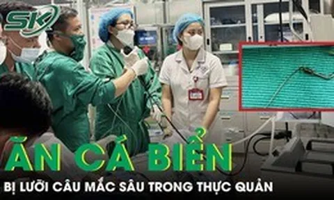 Hiếm gặp: Ăn cá biển, người đàn ông bị lưỡi câu mắc sâu trong thực quản