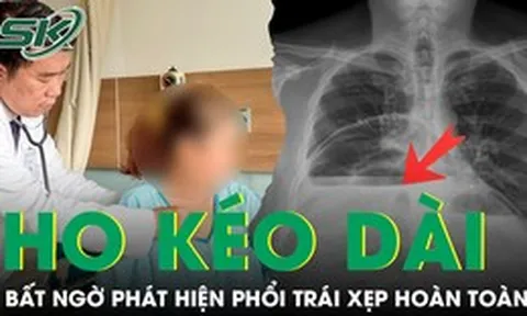 Ho kéo dài nhiều tuần, người phụ nữ bất ngờ phát hiện phổi trái xẹp hoàn toàn vì bệnh hiếm